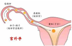 西安女子医院做妇科检查_大爱妇产医院怎么样_大爱妇产女子医院_西安女子医院_大爱妇产医院月经不调_大爱妇产医院无痛人流_小寨妇产医院